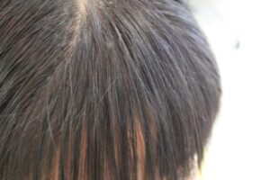 前髪 酸性矯正 「女性にとって 意外と悩む前髪の癖」
